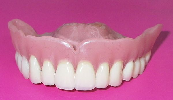 полная имплантация зубов цены