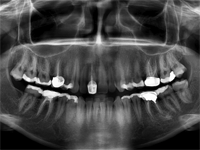 КЛКТ в стоматологии