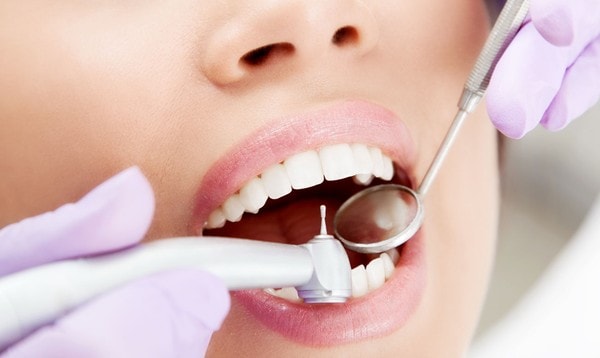 Стоит ли экономить на лечении зубов