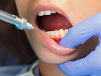 ультракаин в стоматологии