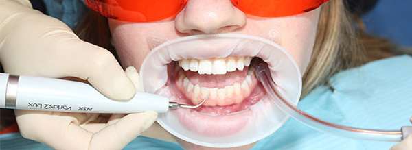 как сохранить зубы здоровыми и крепкими