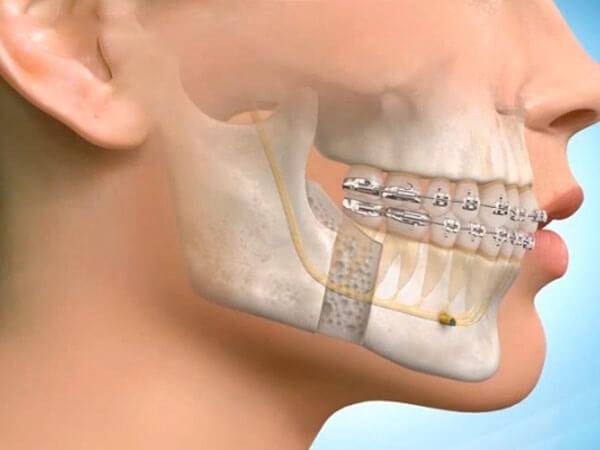 ортодонтия в стоматологии что это такое