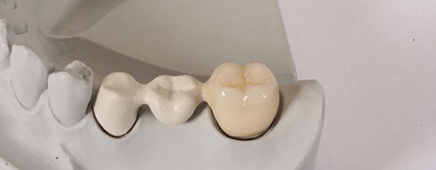 базальная имплантация зубов в Одинцово